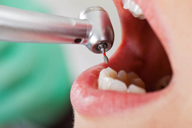 Best Emergency Gum Treatment in Sea Bright, NJ